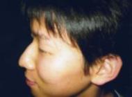 toyabe